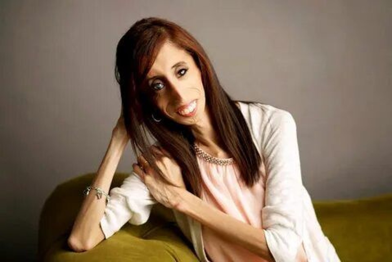 Lizzie velasquez: Dünyanın en çirkin kadını değil,  en cesur kadını... 1